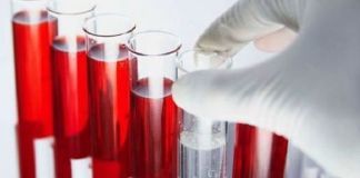 Обнаружение антител к гельминтам в крови