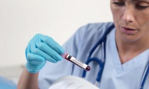 Как обнаруживаются антитела в крови человека к токсокарам