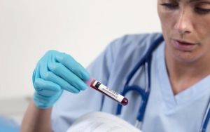 Как обнаруживаются антитела в крови человека к токсокарам