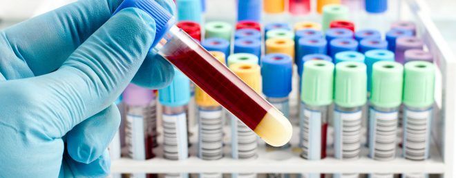 Анализ крови для установления наличия антител