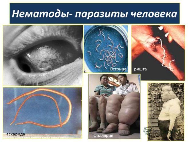 Нематоды- паразиты человека